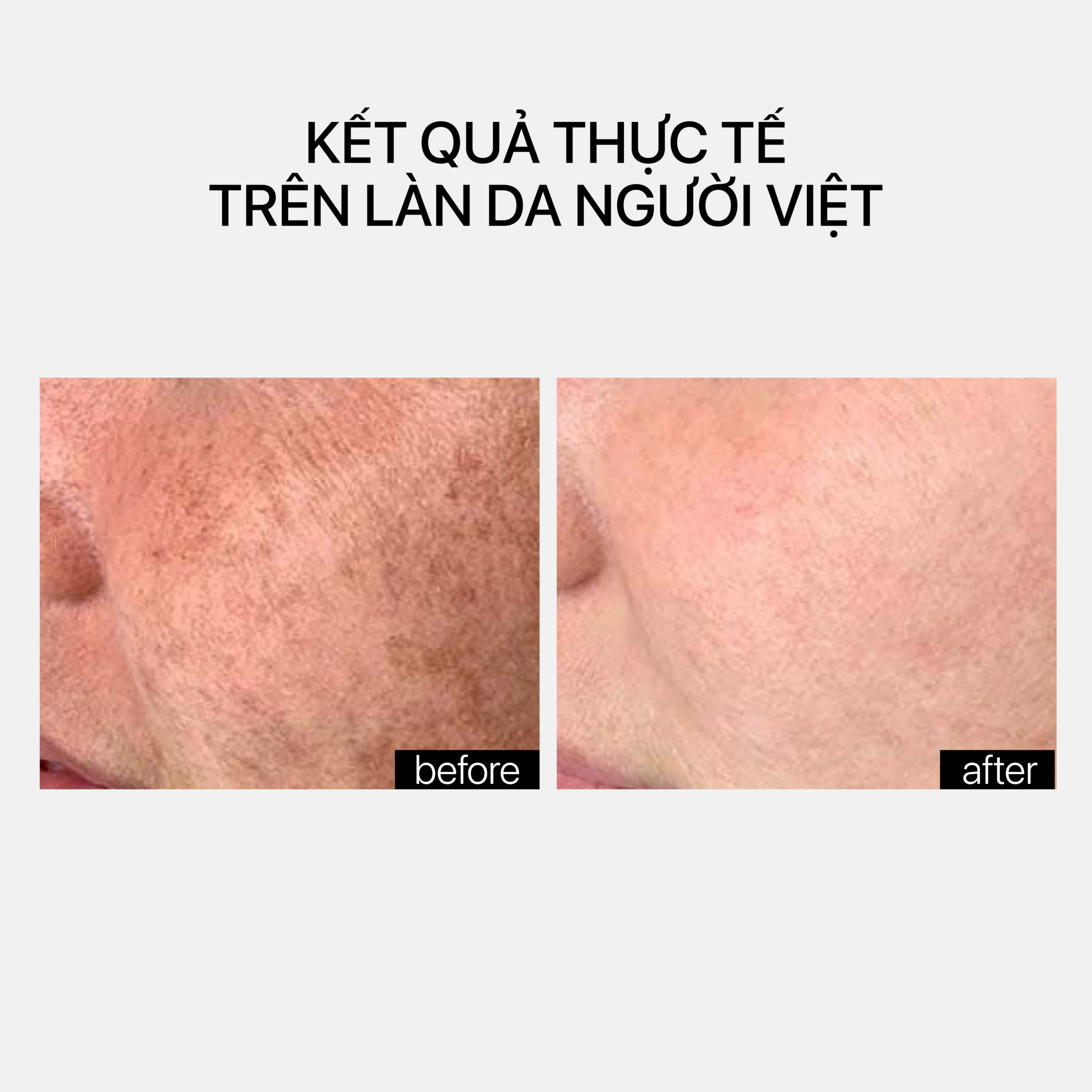 EVEN-IN - Ảnh 4