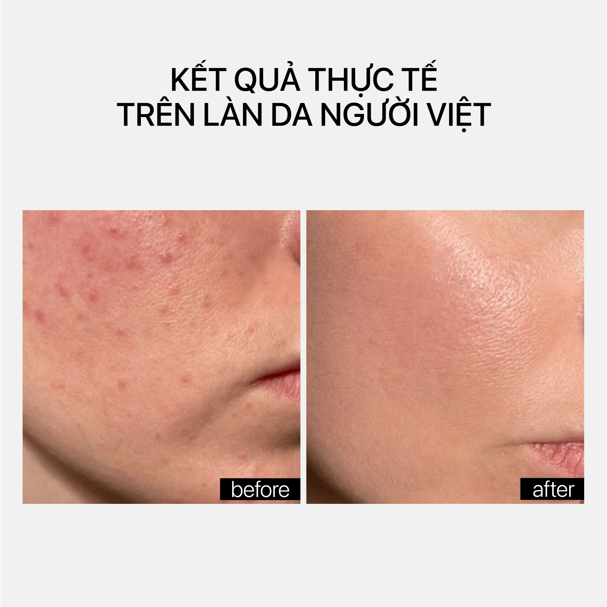 OIL-BASED CLEANSER - Ảnh 4