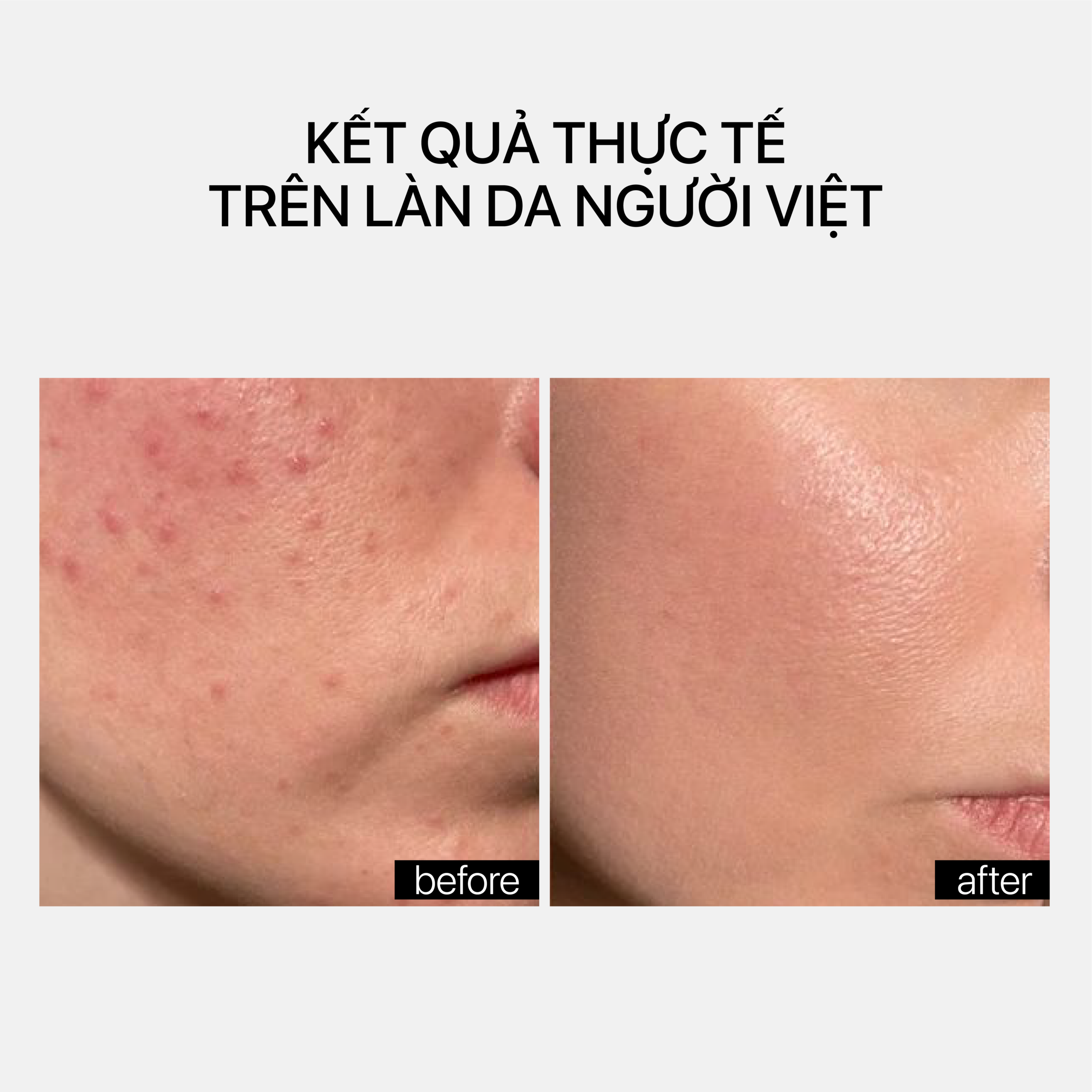 OIL PATROL SERUM - Ảnh 4