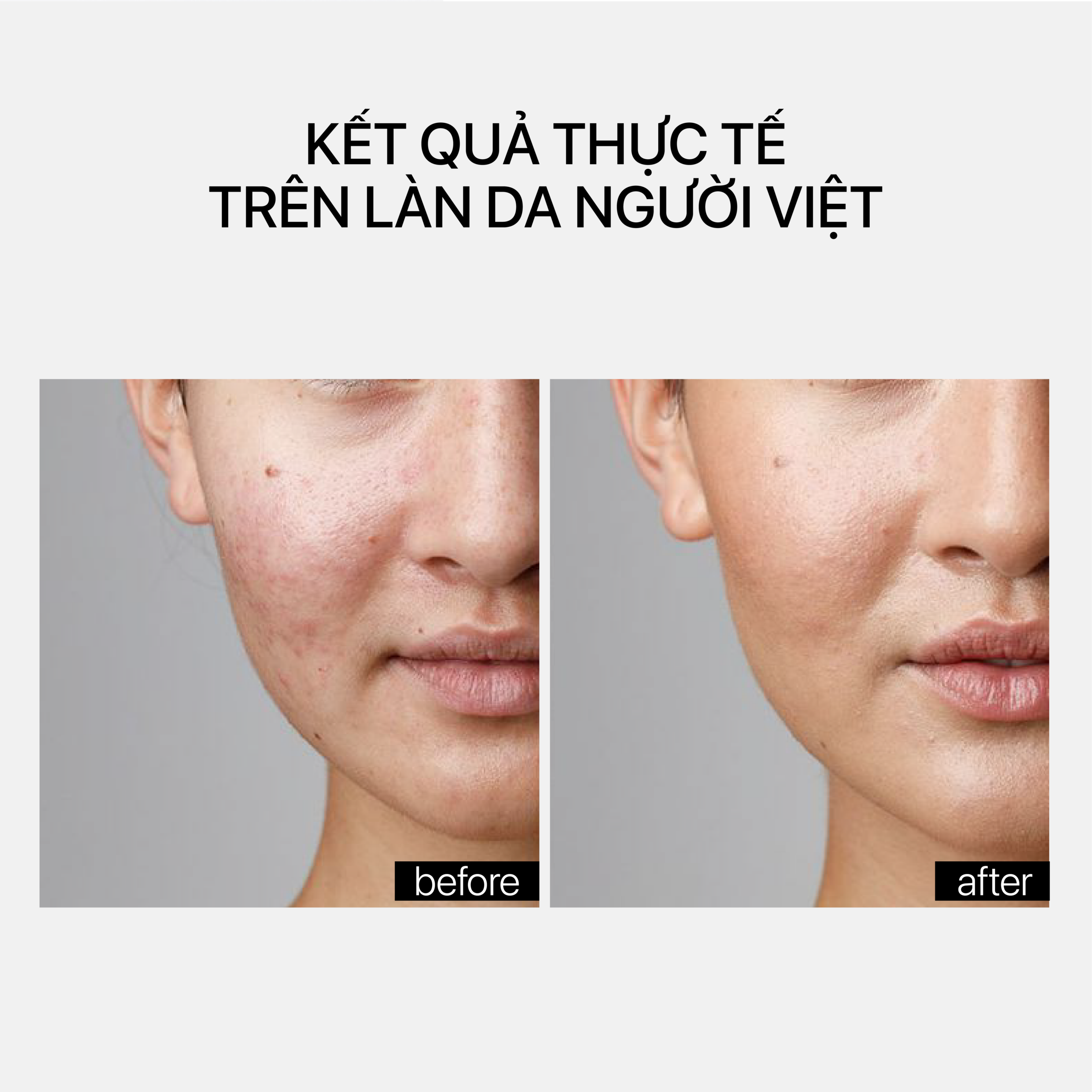 BARRIER RESTORING HYDRATING CREAM - Ảnh 7