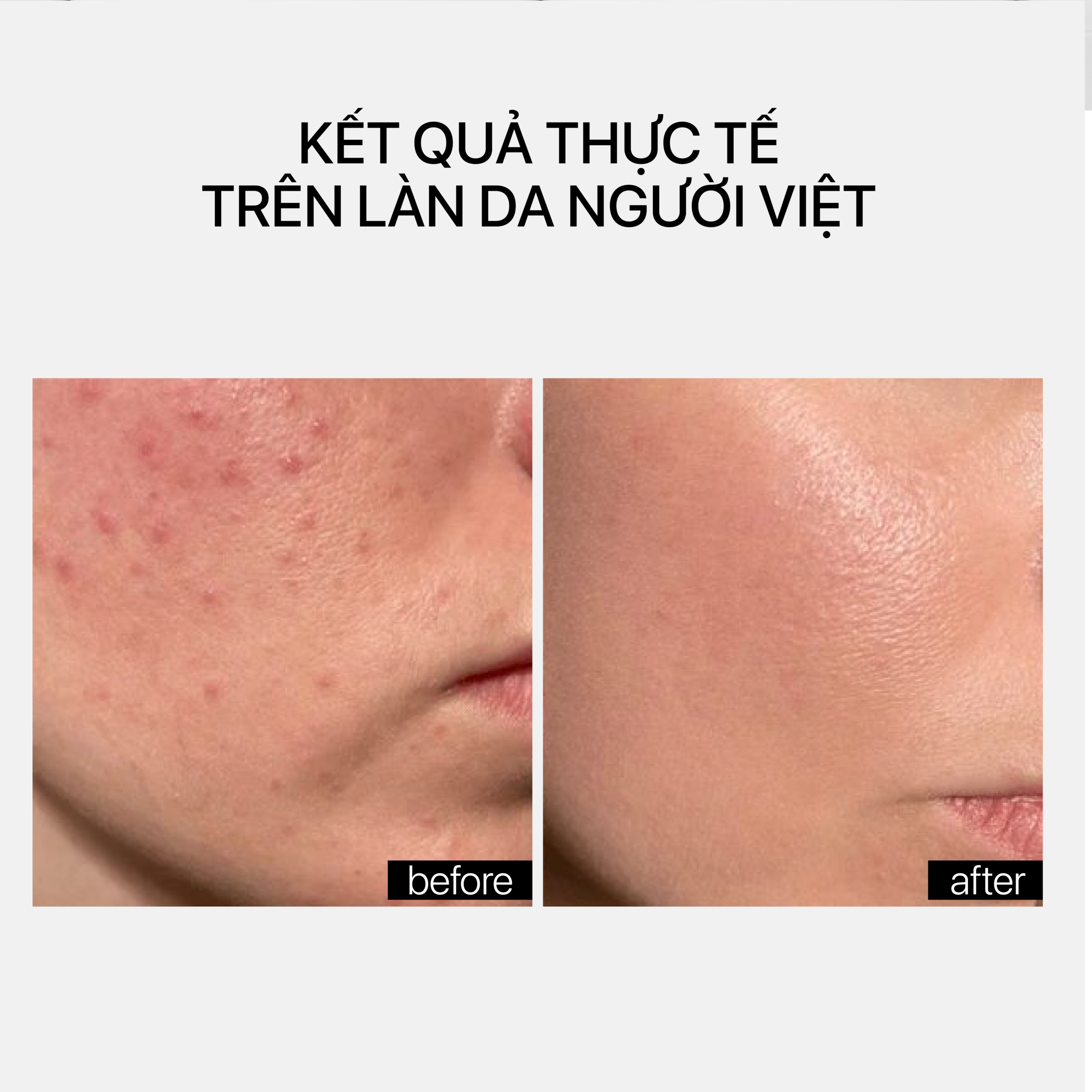 CERAMIDE REPAIR MOISTURIZER - Ảnh 6