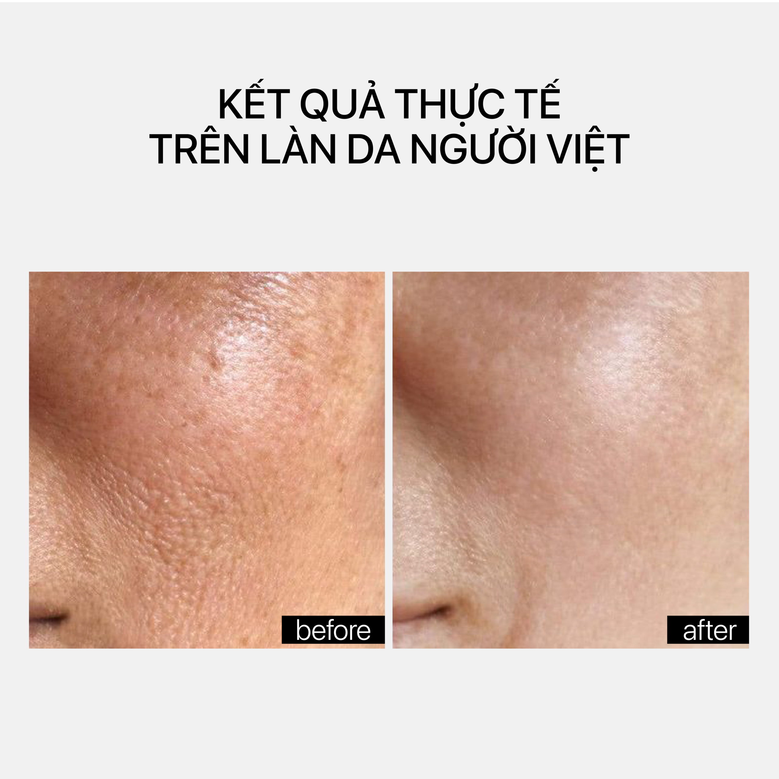 GENTLE REJUVENATION SERUM - Ảnh 5