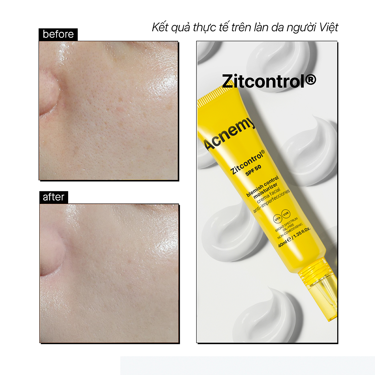 ZITCONTROL® SPF50 - Ảnh 4