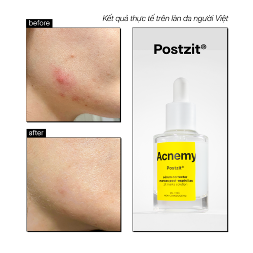 Alternative view of POSTZIT®