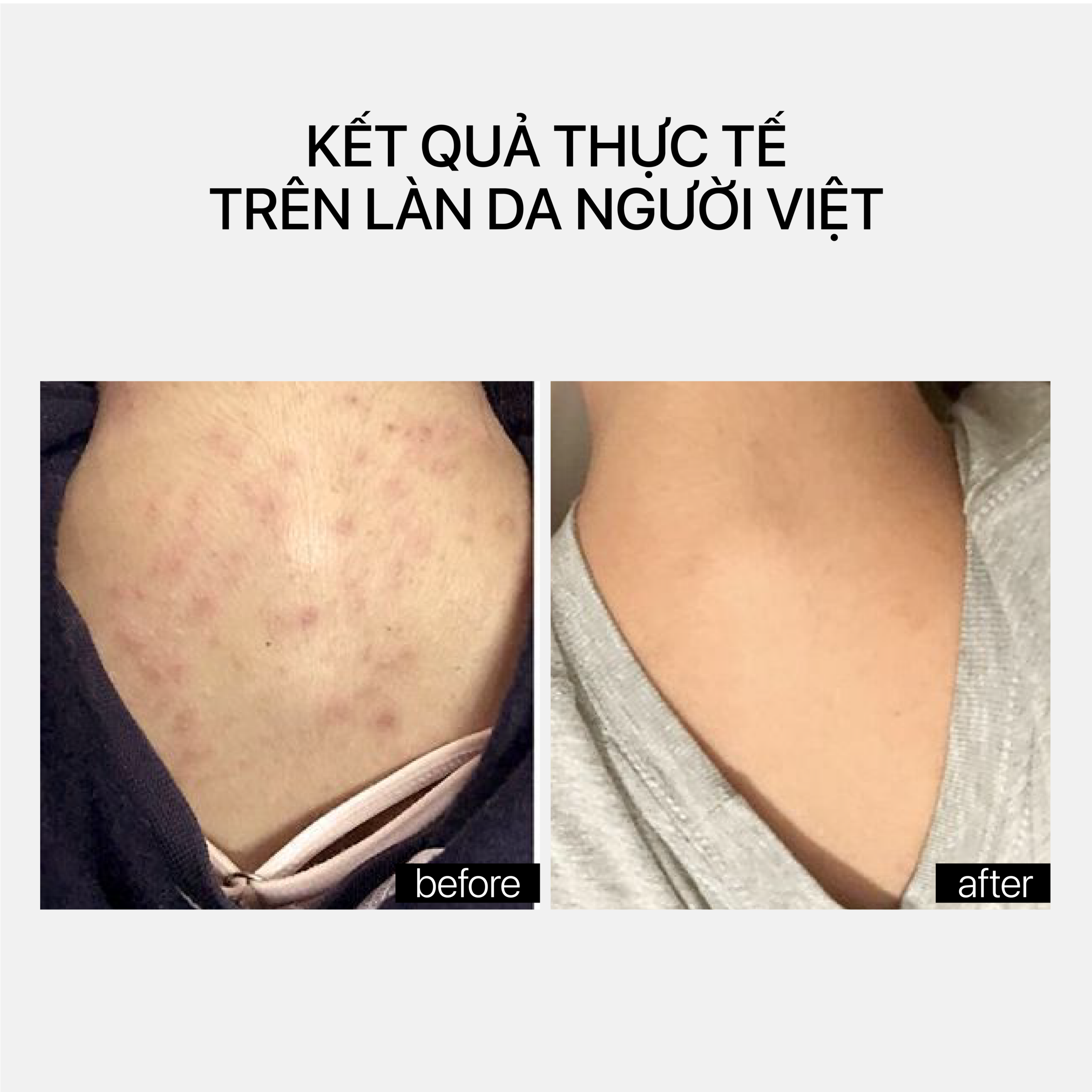 TRANSPARENT LAB AHA SMOOTHING BODY LOTION - Ảnh 2